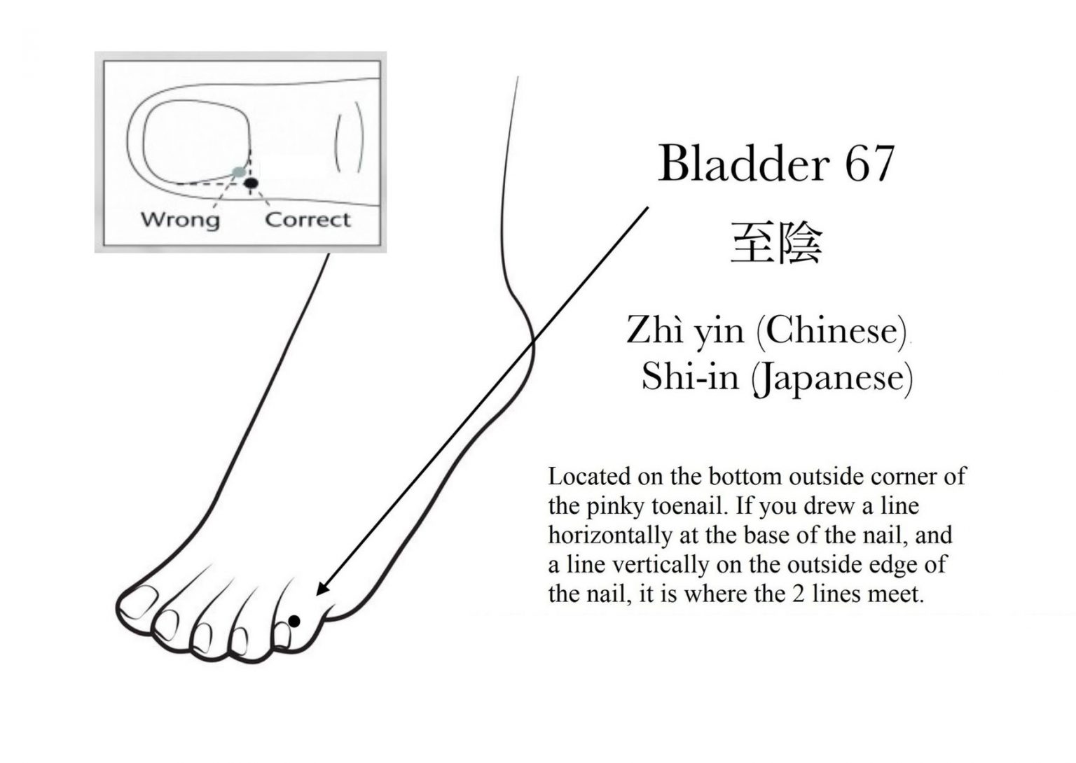 How do you use moxa sticks to help turn a breech baby? Point Specifics